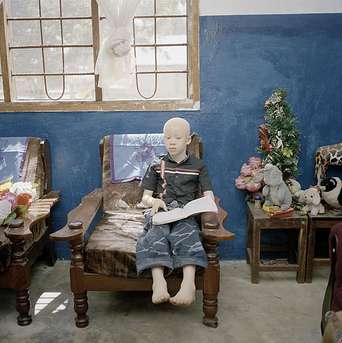 Foto Andri Pol; aus der Serie «Albinos in Tansania»