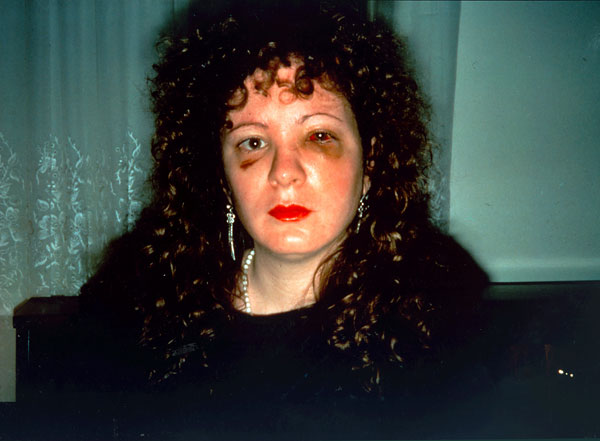 Foto Nan Goldin: Nan one month after being battered, 1984