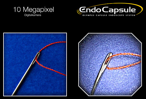 Fotos Vergleichsaufnahmen DSLR und EndoCapsule