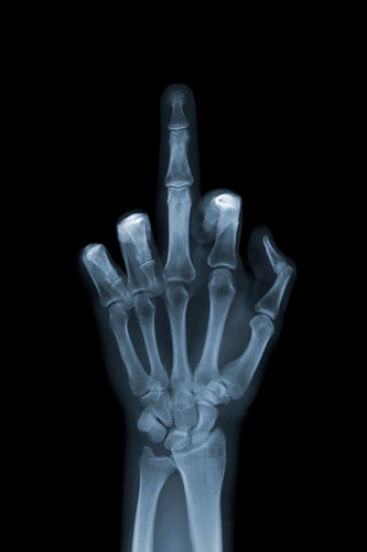Röntgenbild Nick Veasey